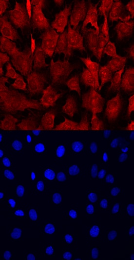 TRAM/TICAM2 antibody in NRK Rat Cell Line by Immunocytochemistry (ICC).