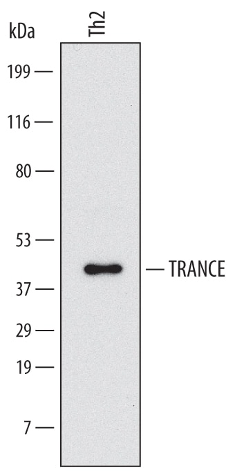Detection of Human TRANCE/TNFSF11/RANK L antibody by Western Blot.