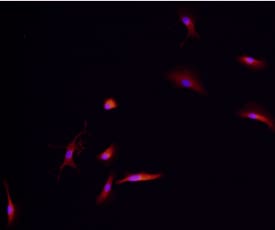 TREM2 antibody in Human Dendritic Cells by Immunocytochemistry (ICC).