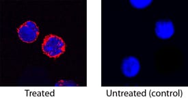 TREM-1 antibody in Mouse Splenocytes by Immunocytochemistry (ICC).