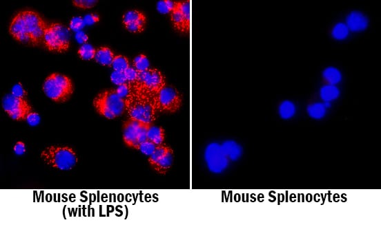 TREM-1 antibody in Mouse Splenocytes by Immunocytochemistry (ICC).