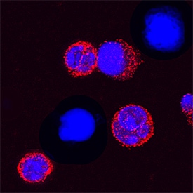 TREM‑1 antibody in Mouse Splenocytes by Immunocytochemistry (ICC).