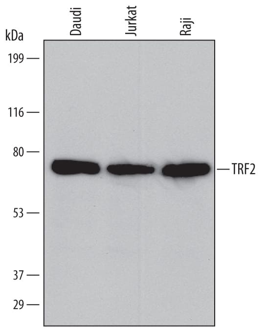 Detection of Human TRF2 antibody by Western Blot.