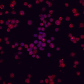 TRIF/TICAM1 antibody in Raji Human Cell Line by Immunocytochemistry (ICC).