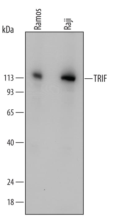 Detection of Human TRIF/TICAM1 antibody by Western Blot.