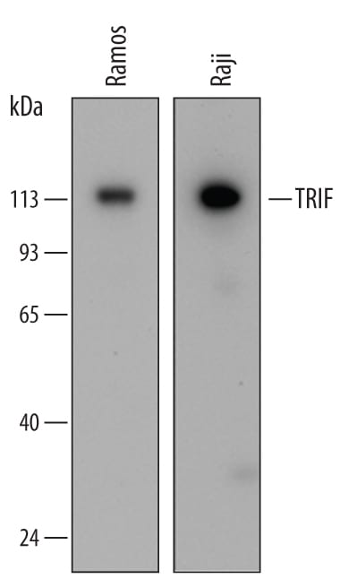 Detection of Human TRIF/TICAM1 antibody by Western Blot.
