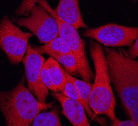TRIM32 antibody in HeLa Human Cell Line by Immunocytochemistry (ICC).