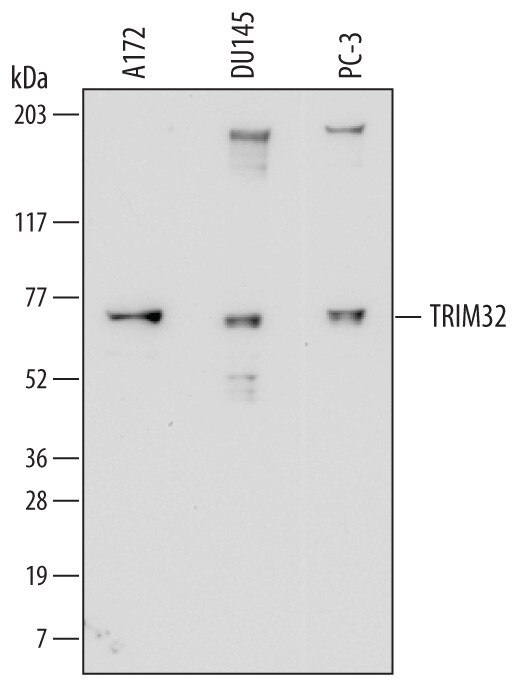 Detection of Human TRIM32 antibody by Western Blot.