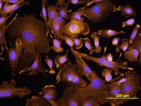 TROP-2 antibody in XB2 Mouse Cell Line by Immunocytochemistry (ICC).