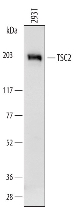 Detection of Human TSC2 antibody by Western Blot.