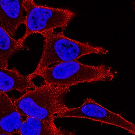 TSC2 antibody in HeLa Human Cell Line by Immunocytochemistry (ICC).