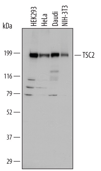 Detection of Human and Mouse TSC2 antibody by Western Blot.
