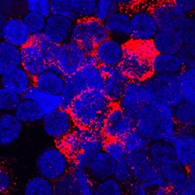 TSG-6 antibody in human PBMCs by Immunocytochemistry (ICC).