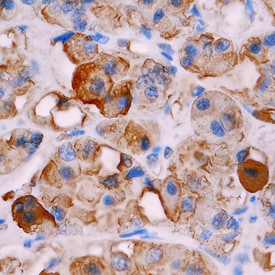 TSH  beta  antibody in Human Pituitary by Immunohistochemistry (IHC-P).