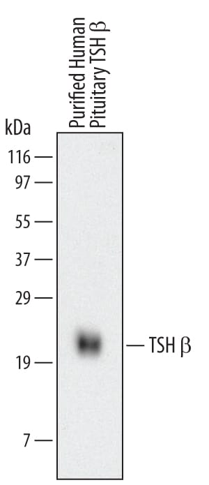 Detection of Human TSH  beta  antibody by Western Blot.