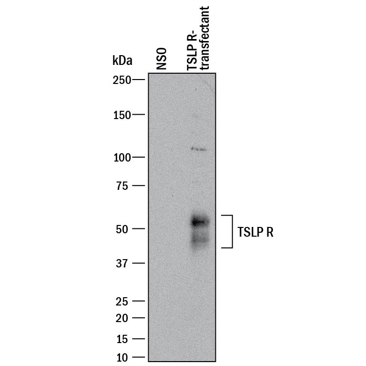 Detection of Human TSLP R antibody by Western Blot.