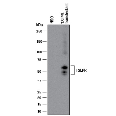 Detection of Human TSLP R antibody by Western Blot.