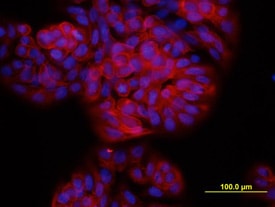 TSPAN8 antibody in HT-29 Human Cell Line by Immunocytochemistry (ICC).