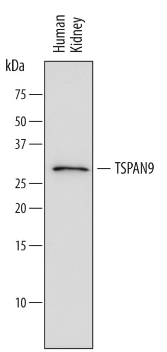 Detection of Human TSPAN9 antibody by Western Blot.