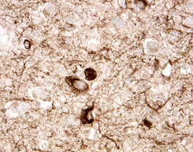 Tau antibody in Human Alzheimer's Disease Brain by Immunohistochemistry (IHC-P).