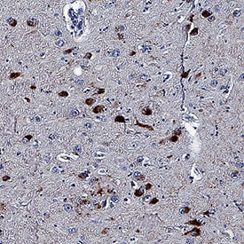 Phospho-Tau (T231) antibody in Human Alzheimer's Brain by Immunohistochemistry (IHC-P).