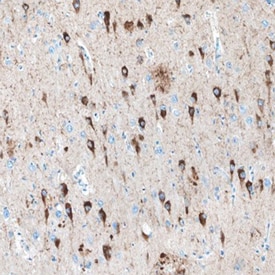 Tau antibody in Human Brain by Immunohistochemistry (IHC-P).