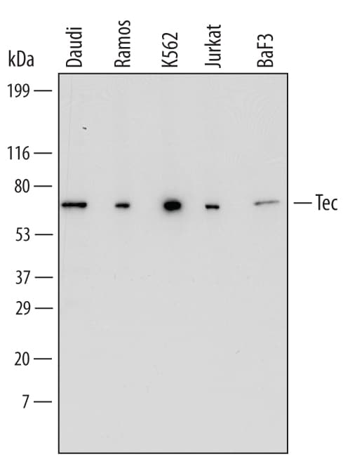 Detection of Human and Mouse Tec antibody by Western Blot.