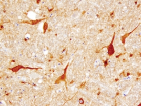 Tenascin R antibody in Human Brainstem by Immunohistochemistry (IHC-P).