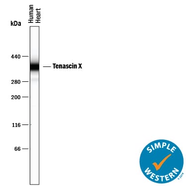 Detection of Human Tenascin X antibody by Simple WesternTM.