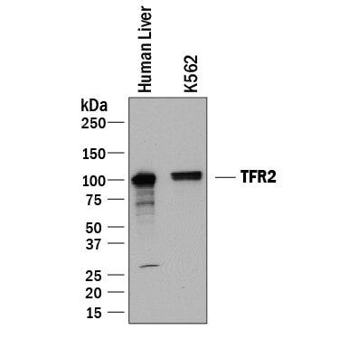 Detection of Human TfR2 antibody by Western Blot.