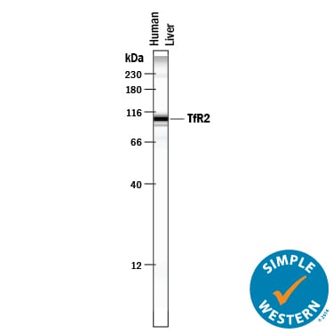 Detection of Human TfR2 antibody by Simple WesternTM.