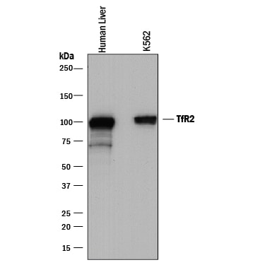 Detection of Human TfR2 antibody by Western Blot.