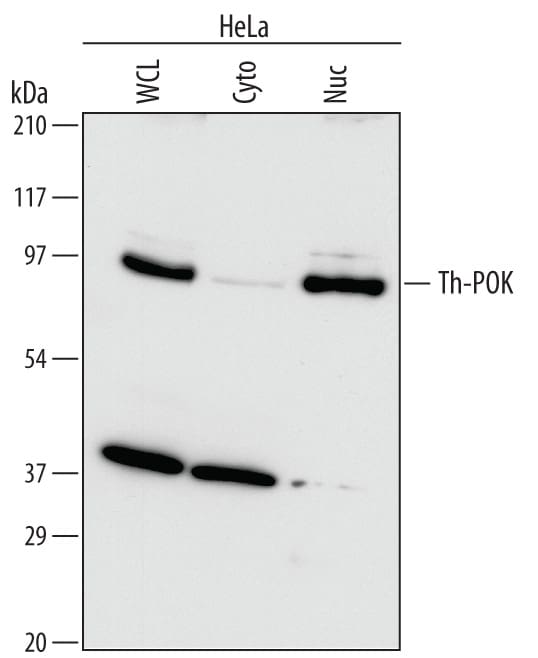 Detection of Human Th-POK antibody by Western Blot.