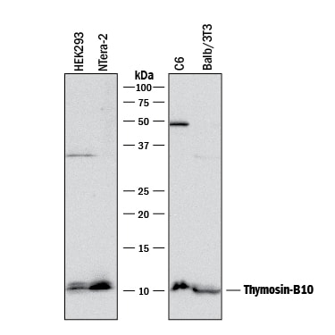 Detection of Human, Mouse, and Rat Thymosin  beta 10 antibody by Western Blot.