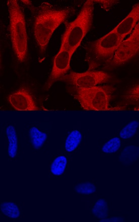 Thymosin  beta 4 antibody in HeLa Human Cell Line by Immunocytochemistry (ICC).