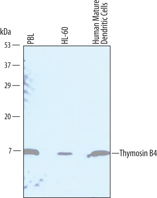 Detection of Human Thymosin  beta 4 antibody by Western Blot.