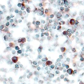 CXCL7/Thymus Chemokine‑1 antibody in Mouse Thymus by Immunohistochemistry (IHC-Fr).