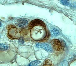 Tie‑1 antibody in Human Placenta by Immunohistochemistry (IHC-P).