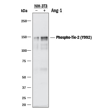 Detection of Mouse Phospho-Tie-2 (Y992) antibody by Western Blot.