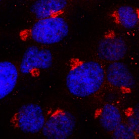 Tissue a-L-Fucosidase/FUCA1 antibody in HeLa Human Cell Line by Immunocytochemistry (ICC).
