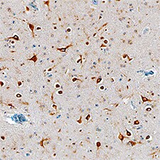 Tmp21/p23 antibody in Human Alzheimer's Brain by Immunohistochemistry (IHC-P).