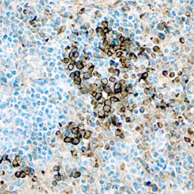 Transferrin antibody in Mouse Thymus by Immunohistochemistry (IHC-Fr).