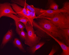 Transgelin/TAGLN antibody in MCF 10A Human Cell Line by Immunocytochemistry (ICC).