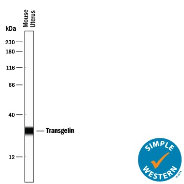 Detection of Mouse Transgelin/TAGLN antibody by Simple WesternTM.