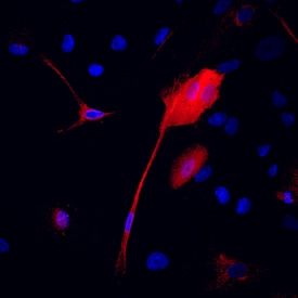 Transgelin/TAGLN antibody in MCF 10A Human Cell Line by Immunocytochemistry (ICC).
