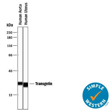 Detection of Human Transgelin/TAGLN antibody by Simple WesternTM.