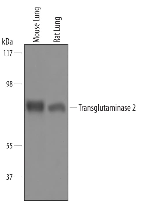 Detection of Mouse and Rat Transglutaminase 2/ TGM2 antibody by Western Blot.