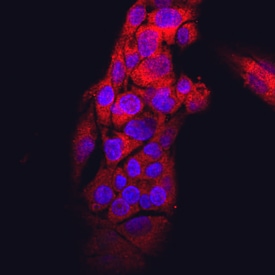 Transthyretin/Prealbumin antibody in HepG2 Human Cell Line by Immunocytochemistry (ICC).