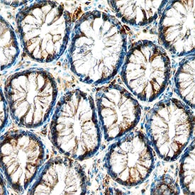 TrkA antibody in Human Colon by Immunohistochemistry (IHC-P).