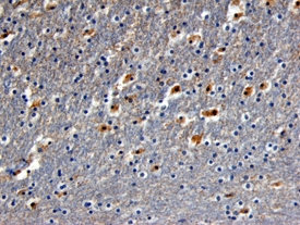 TrkB antibody in Human Brain by Immunohistochemistry (IHC-P).